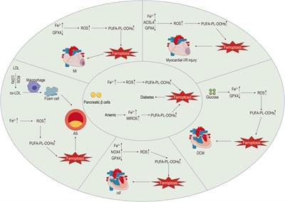 The role of ferroptosis in diabetic cardiovascular diseases and the intervention of active ingredients of traditional Chinese medicine